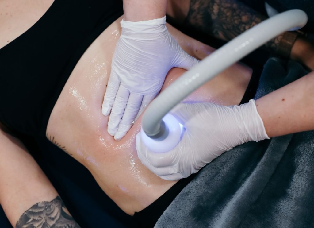 CryoSkin Therapy being performed on woman's belly at Restore