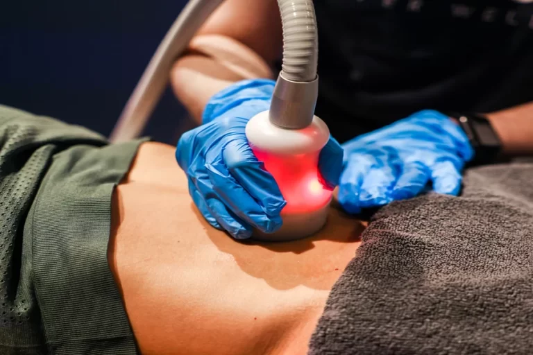 Woman receiving a Cryoslimming Treatment at Restore Hyper Wellness in North Mt Pleasant