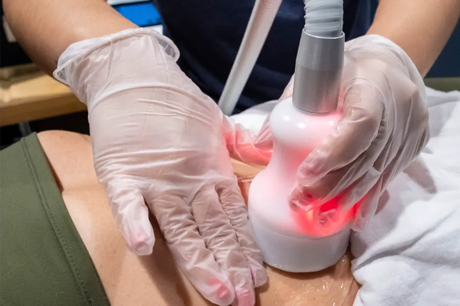 a close up of a cryoskin treatment.