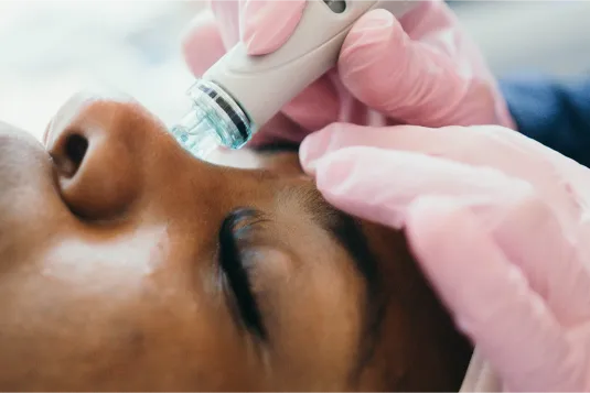 a close up of a woman getting a hydra facial treatment.