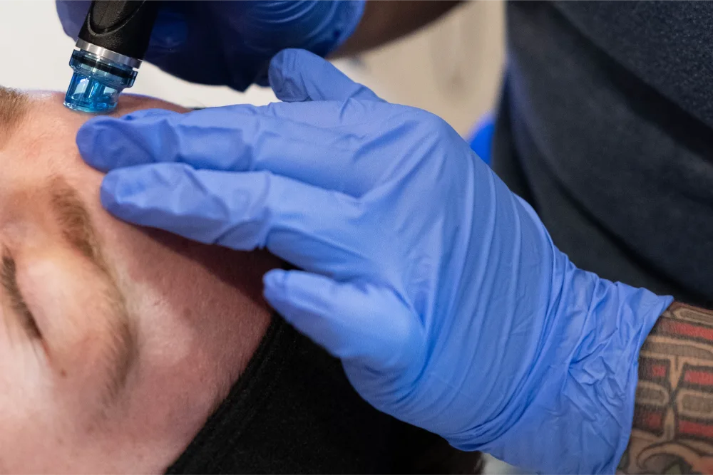 Person with blue gloves doing a Hydrafacial to a customer.